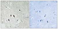 RIP2 Polyclonal Antibody