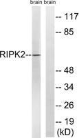 RIP2 Polyclonal Antibody