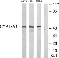 CYP17A1 Polyclonal Antibody