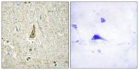 CYP26C1 Polyclonal Antibody