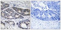 CYP2R1 Polyclonal Antibody