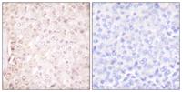 Cystatin B Polyclonal Antibody