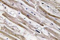 Cytokeratin 13 Polyclonal Antibody