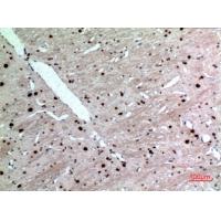 Cytokeratin 14 Polyclonal Antibody
