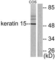 Cytokeratin 15 Polyclonal Antibody