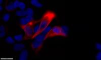 Cytokeratin 17 Polyclonal Antibody