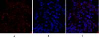 Cytokeratin 18 Polyclonal Antibody