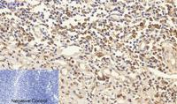 Cytokeratin 18 Polyclonal Antibody