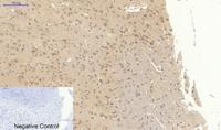 Cytokeratin 18 Polyclonal Antibody