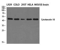 Cytokeratin 18 Polyclonal Antibody