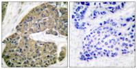 Cytokeratin 5 Polyclonal Antibody
