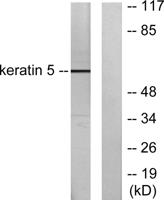 Cytokeratin 5 Polyclonal Antibody