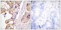 Cytokeratin 8 Polyclonal Antibody