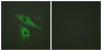 Cytokeratin 8 Polyclonal Antibody