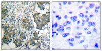 Cytokeratin 8 Polyclonal Antibody