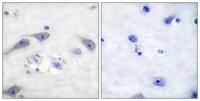 DARPP-32 Polyclonal Antibody