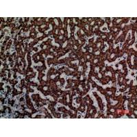 DCI Polyclonal Antibody