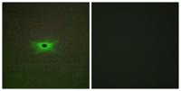 AMPKγ2 Polyclonal Antibody
