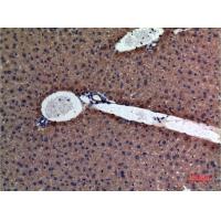Amylase Polyclonal Antibody
