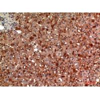 ANG I Polyclonal Antibody