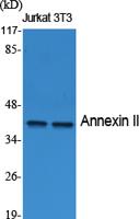 Annexin II Polyclonal Antibody