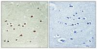 DDX51 Polyclonal Antibody