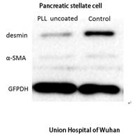Desmin Polyclonal Antibody