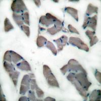 Desmin Polyclonal Antibody