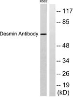 Desmin Polyclonal Antibody