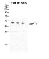 DGAT2L3 Polyclonal Antibody
