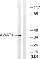 DGAT2L3 Polyclonal Antibody
