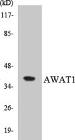 DGAT2L3 Polyclonal Antibody