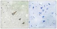 DGK-κ Polyclonal Antibody
