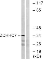 DHHC-7 Polyclonal Antibody