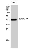 DHHC-9 Polyclonal Antibody