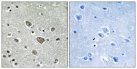 DHHC-9 Polyclonal Antibody