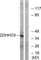 DHHC-9 Polyclonal Antibody