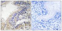 DHODH Polyclonal Antibody