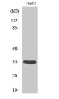 DHRS4 Polyclonal Antibody