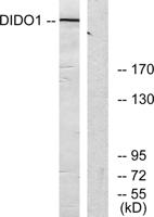 Dio-1 Polyclonal Antibody