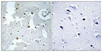 DJ-1 Polyclonal Antibody