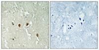 DJ-1 Polyclonal Antibody