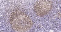 Plk Polyclonal Antibody