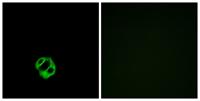 APLNR Polyclonal Antibody