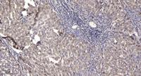 DOCK 2 Polyclonal Antibody