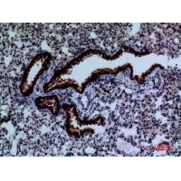 DPYD Polyclonal Antibody