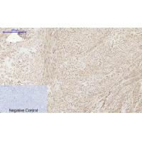 AR Polyclonal Antibody