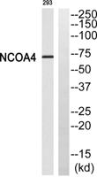 ARA70 Polyclonal Antibody