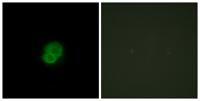 ARMCX2 Polyclonal Antibody
