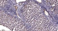 ARMCX2 Polyclonal Antibody